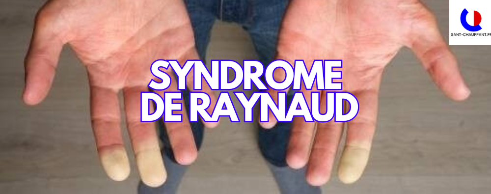 syndrome de raynaud